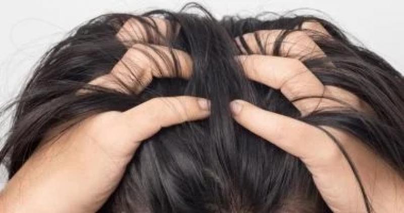 مشاكل فروة الرأس.. إزاى تهتم بشعرك ومتى تذهب إلى الطبيب؟