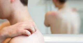 فاكسيرا تكشف طريقة علاج الإصابة بالحزام النارى.. اعرف التفاصيل
