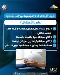 كيف تؤثر الولادة القيصرية غير المبررة طبيا على الأطفال؟.. إنفوجراف
