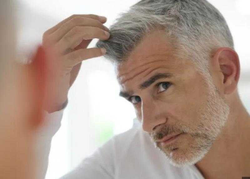 وصفات طبيعية للتخلص من الشيب المبكر فى الشعر