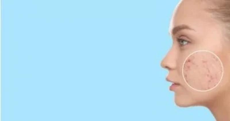 اليوم الاخباري