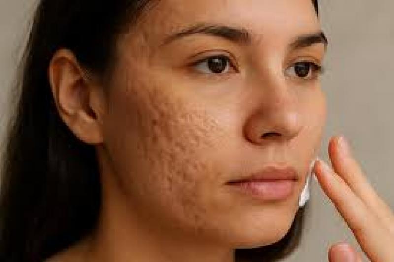 اليوم الاخباري