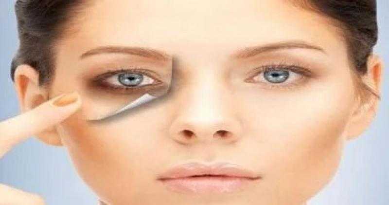 وصفات طبيعية للتخلص من الهالات السوداء تحت العين.. مش محتاجة كونسيلر