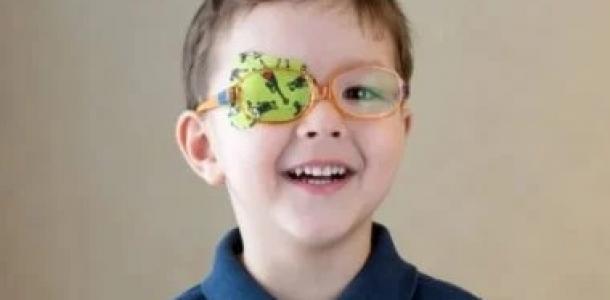 هل يمكن علاج كسل العين؟.. أهمية الرعاية المبكرة