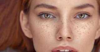 النمشات والبقع الدموية على الجلد.. إشارات صغيرة قد تكشف اضطرابا داخل الجسم