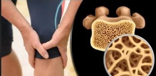 6 أطعمة تقلل خطر الإصابة بكسور العظام لدى المصابين بالهشاشة