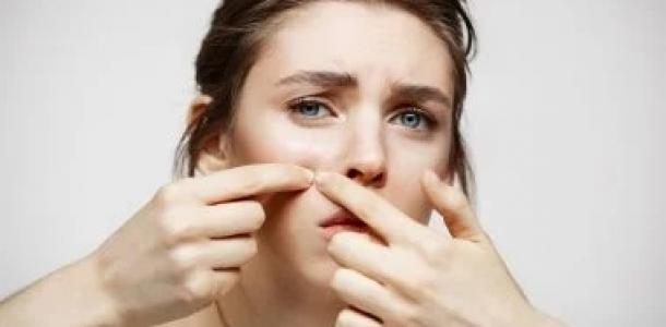 4 وصفات طبيعية للتخلص من البثور قبل مناسباتك المهمة.. الثوم كلمة السر