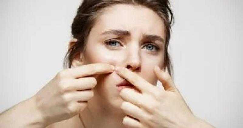 4 وصفات طبيعية للتخلص من البثور قبل مناسباتك المهمة.. الثوم كلمة السر