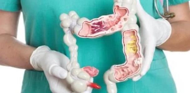 4 طرق لتقليل خطر الإصابة بسرطان الأمعاء وطرق الوقاية