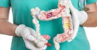 4 طرق لتقليل خطر الإصابة بسرطان الأمعاء وطرق الوقاية