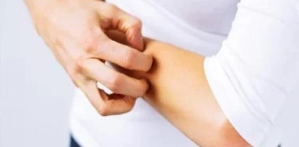 طرق طبيعية للوقاية من لدغات الناموس