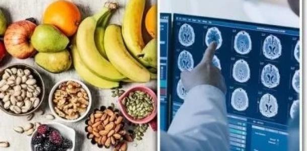 لحماية الذاكرة.. 8 أطعمة تقلل خطر الخرف