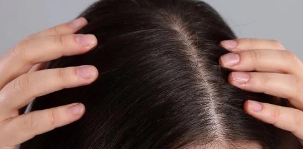وصفات طبيعية للعناية بالشعر في الصيف