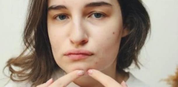 اسباب لا تعرفها عن زيادة حب الشباب ..كيف يمكن الوقاية؟