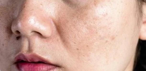 7 أخطاء يومية في روتين العناية بالبشرة تضر نضارتك