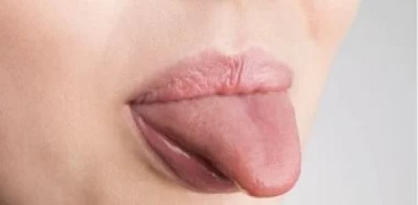 ماذا يكشف لسانك عن صحتك؟.. 7 تغيرات لا تتجاهلها ومتى تحتاج لزيارة الطبيب