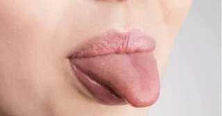 ماذا يكشف لسانك عن صحتك؟.. 7 تغيرات لا تتجاهلها ومتى تحتاج لزيارة الطبيب