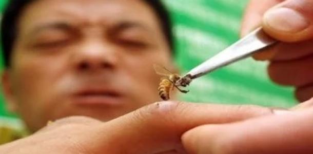 إذا تعرضت للدغة دبور أو نحلة.. 9 أعراض تحذيرية لا تتجاهلها