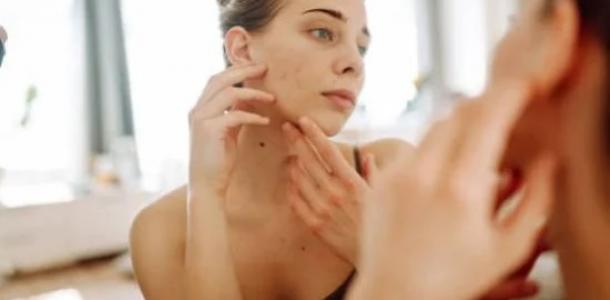 بشرتك عنوان جمالك.. أبرز 8 مشاكل جلدية شائعة وطرق بسيطة للسيطرة عليها